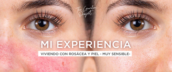 Mi experiencia viviendo con rosácea y piel - muy sensible-