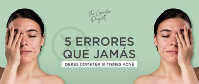 5 errores que JAMÁS debes cometer si tienes acné